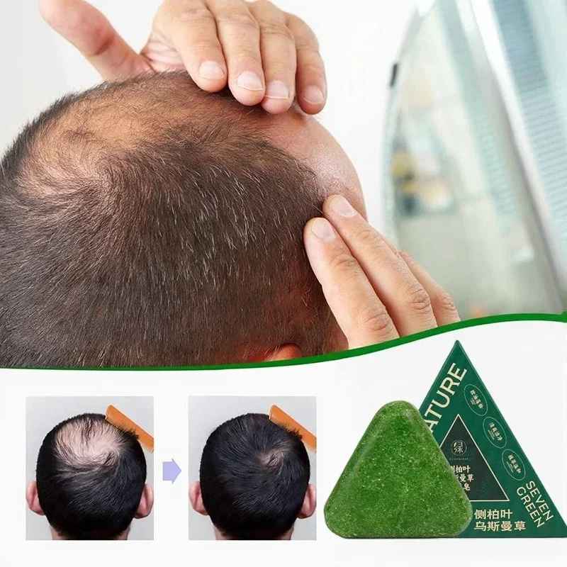 صابونة الأعشاب الصينية